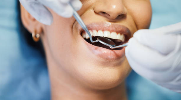 Best Emergency Treatment for Dental Infections or Abscesses in Stockton University, NJ