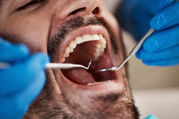 Best Emergency Denture Repair in Stockton University, NJ