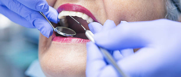 Best Emergency Treatment for Dental Infections or Abscesses in Stockton University, NJ
